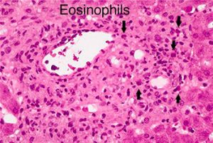 эозинофилы под микроскопом