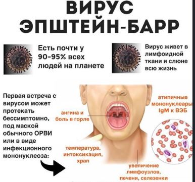 симптомы вируса Эпштейна-Барр
