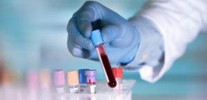 сданный анализ крови на антитела