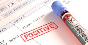 позитивный тест на ВИЧ