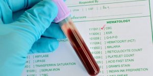 изучение анализа крови на гематокрит