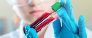 изучение крови на вязкость